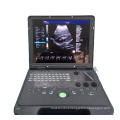 Clear Imaging 3D/4D Portable Color Doppler Echocardiography Ultrasound scanner machine price for Pregnancy